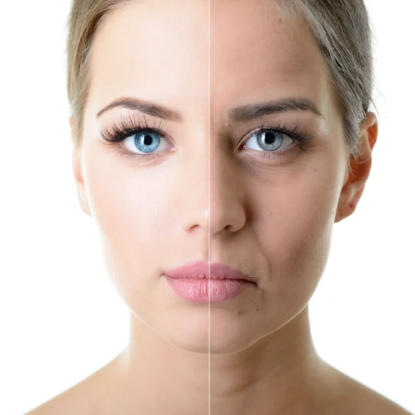 Split comparison of a youthful and an aged face, showing how dermal fillers restore lost volume