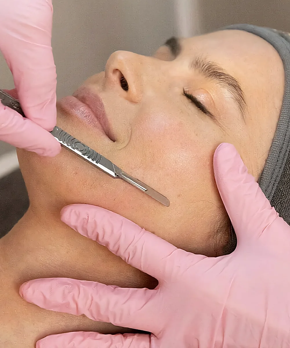Dermaplaning facial treatment with a blade on a client's cheek